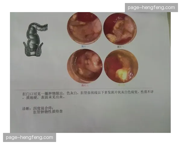 评论：引入混合团体项目是BMX走向更主流观众的关键一步